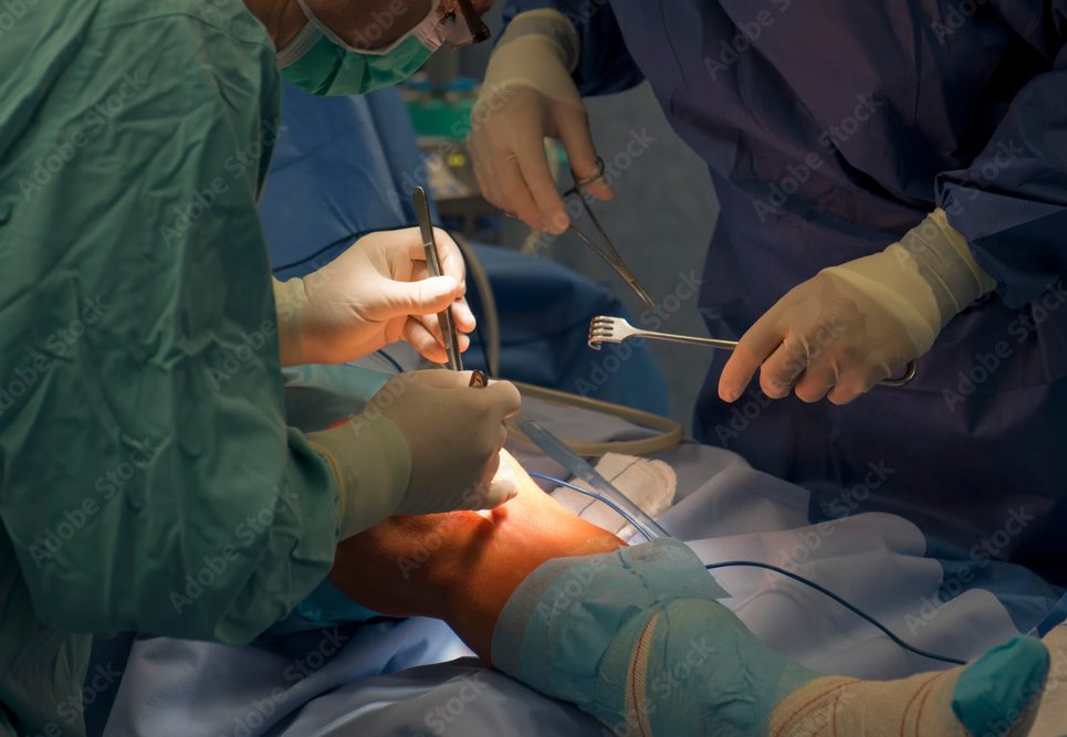 Total Knee Replacement